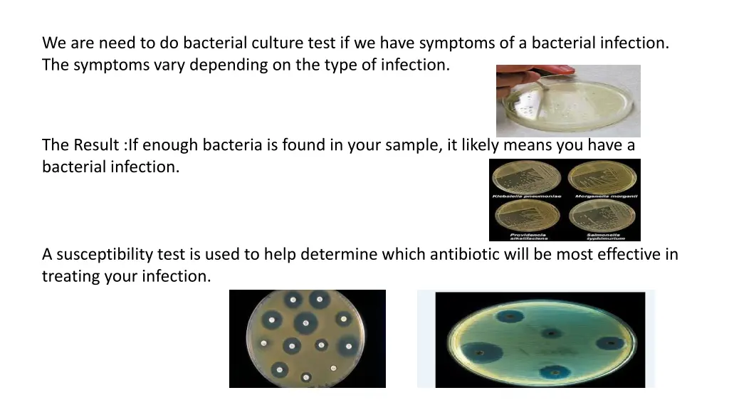 we are need to do bacterial culture test