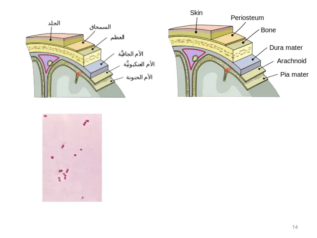 slide14