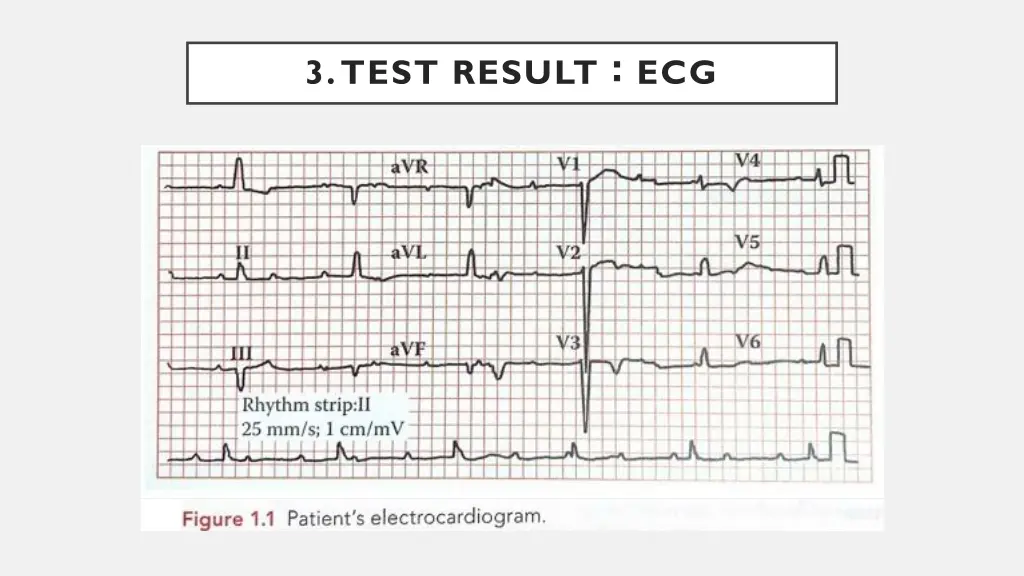 3 test result