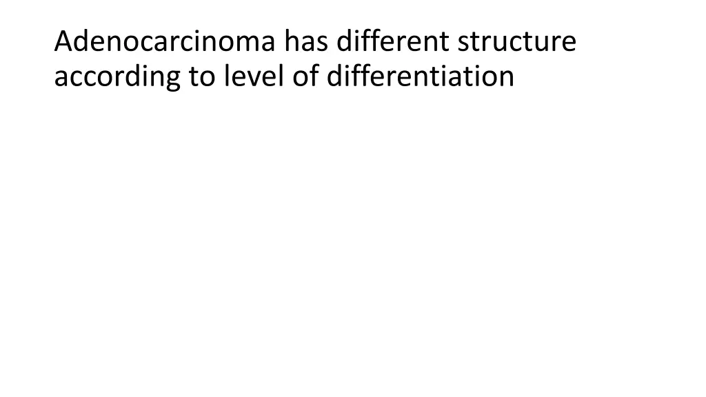 adenocarcinoma has different structure according