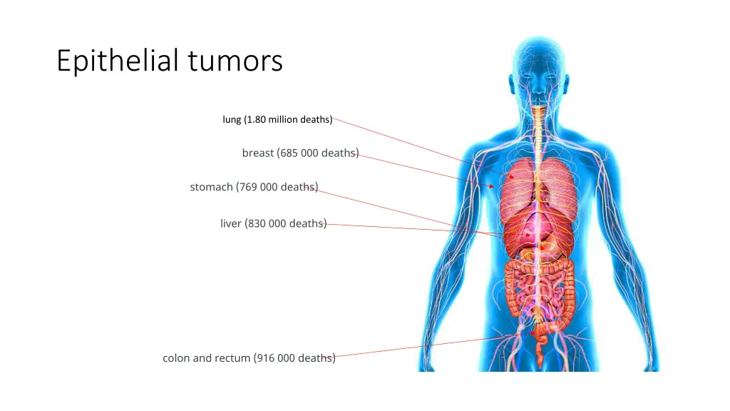 epithelial tumors 1