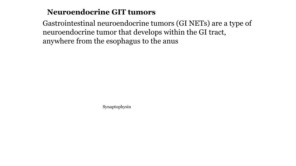 neuroendocrine git tumors gastrointestinal
