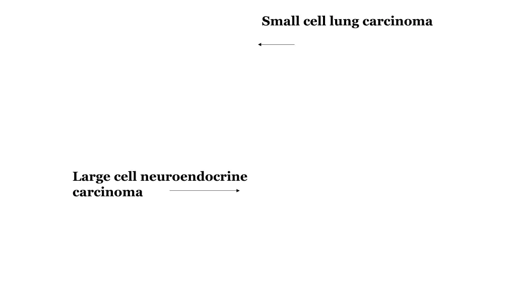 small cell lung carcinoma