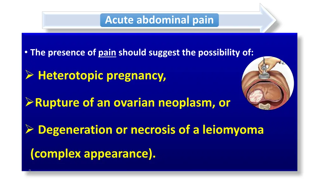 acute abdominal pain 1