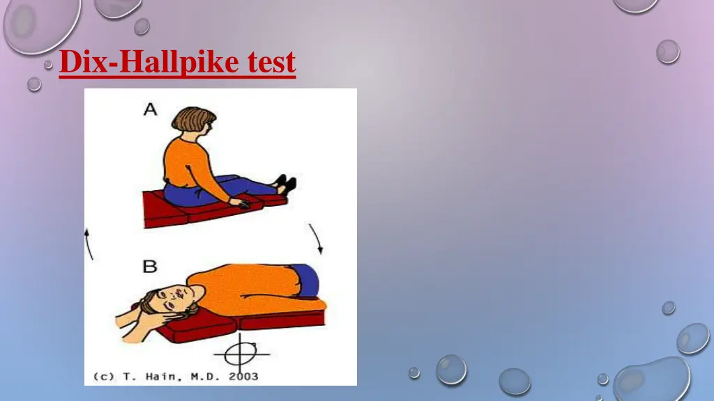 dix hallpike test 1