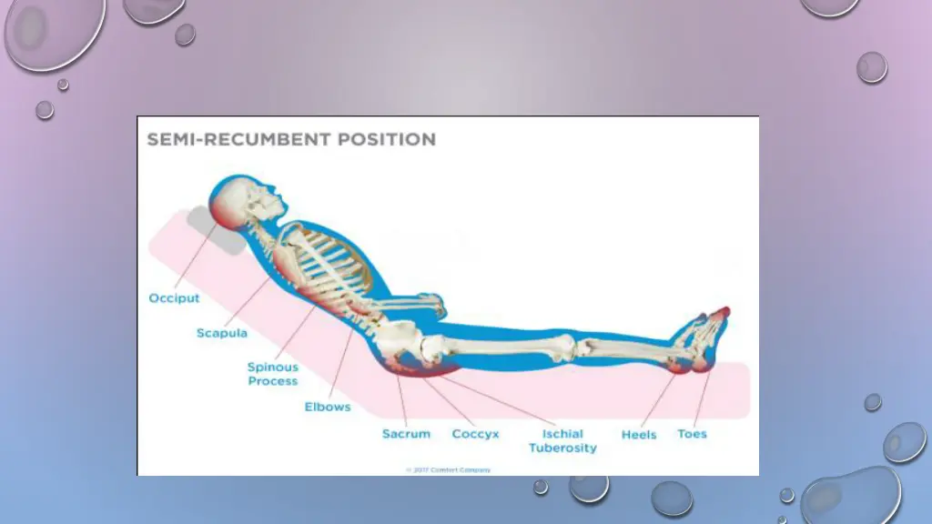 slide25