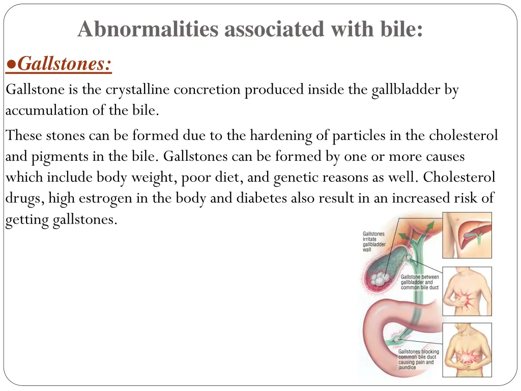 abnormalities associated with bile gallstones