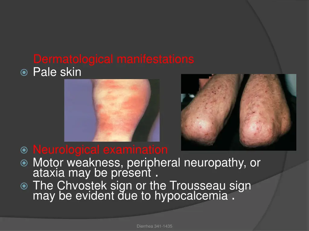 dermatological manifestations pale skin