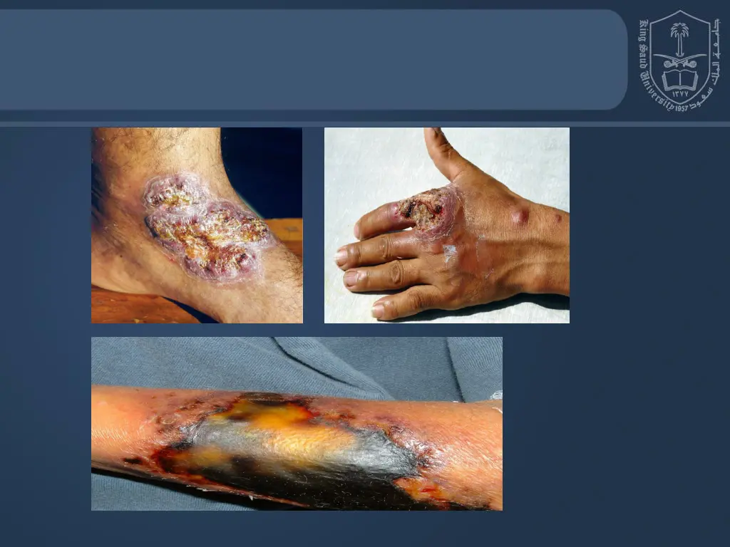 slide11
