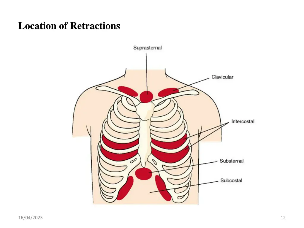 location of retractions