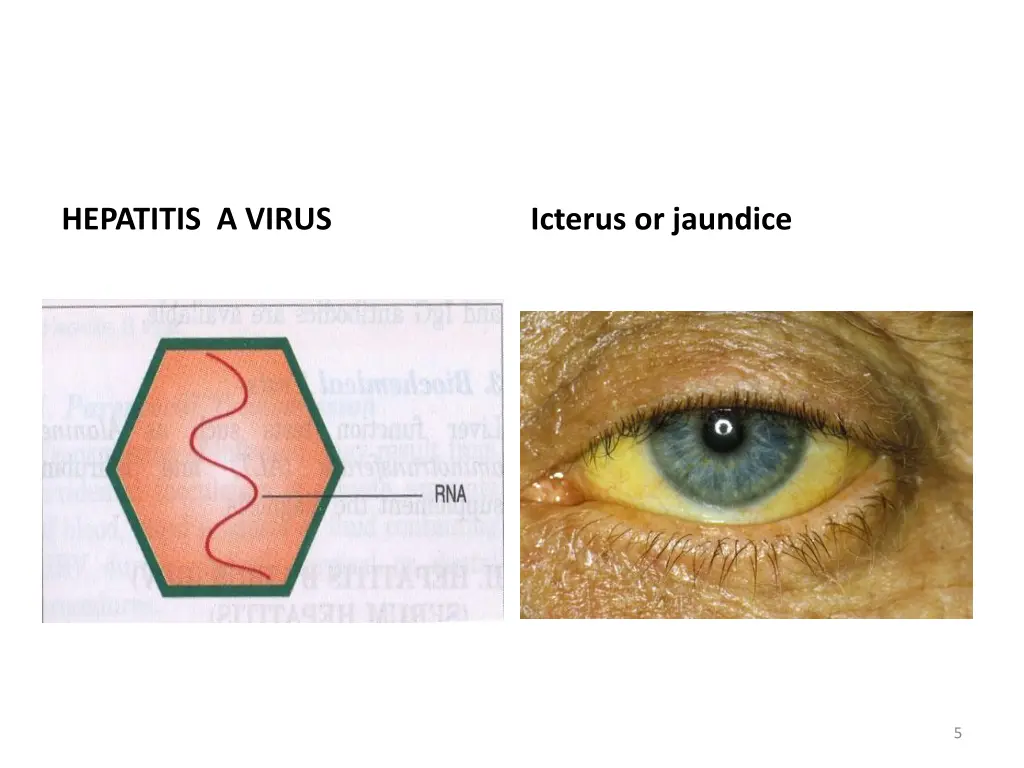 hepatitis a virus