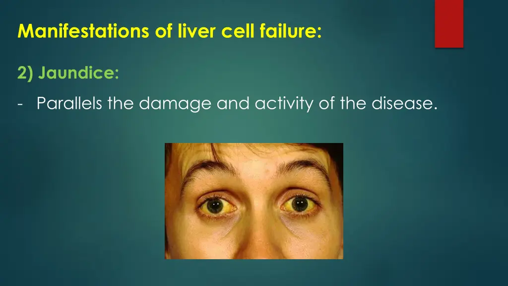 manifestations of liver cell failure 1