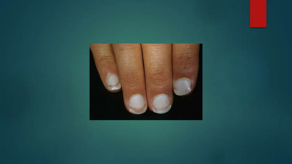 slide28