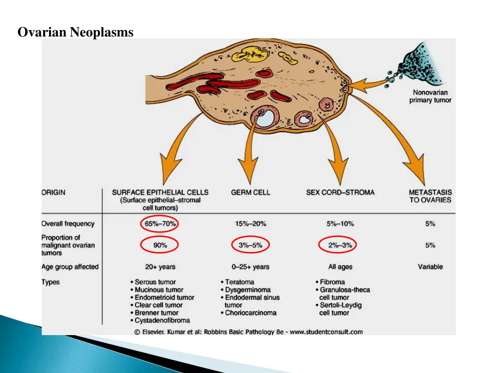 ovarian neoplasms
