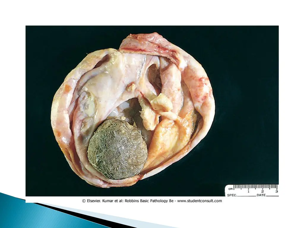 slide19