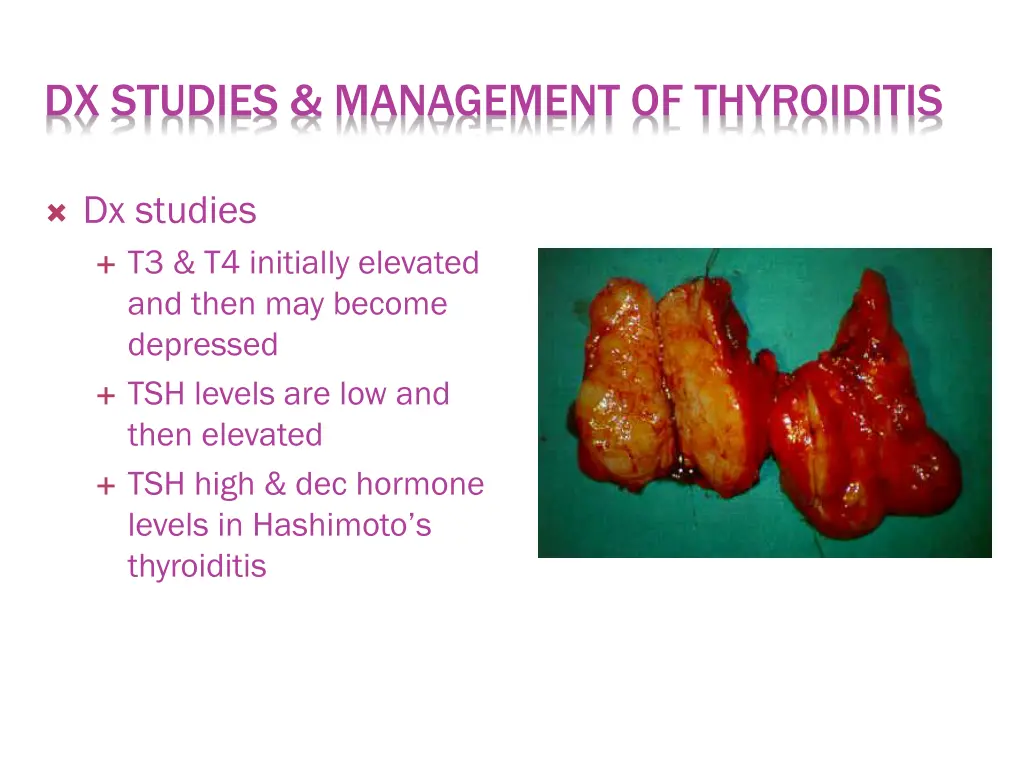 dx studies management of thyroiditis