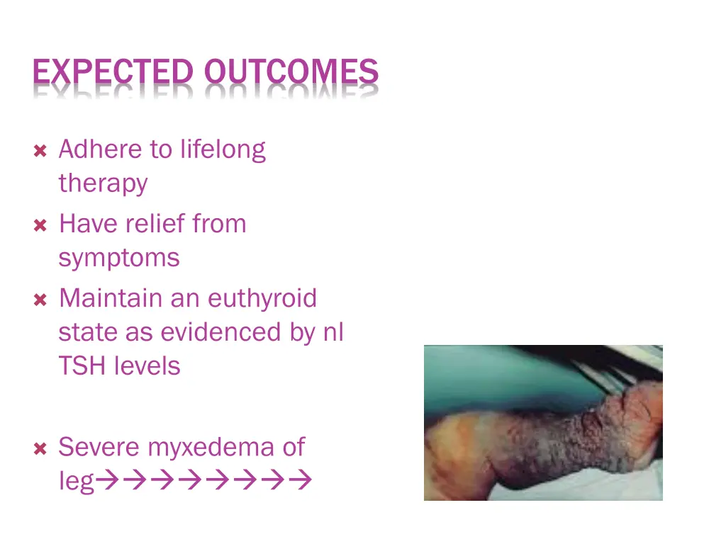 expected outcomes