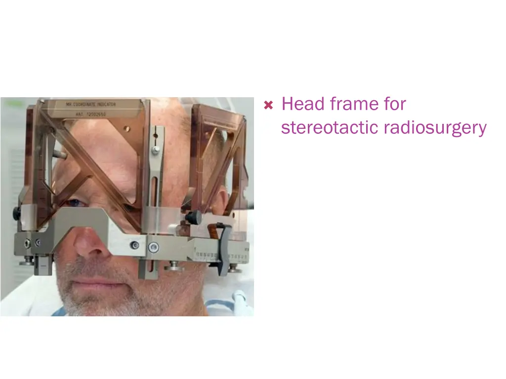 head frame for stereotactic radiosurgery