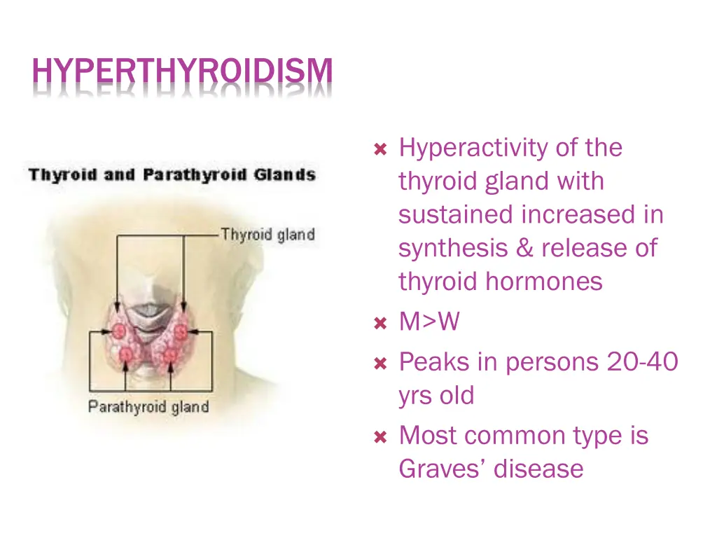 hyperthyroidism