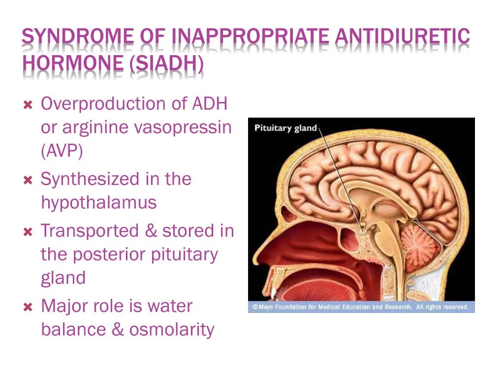 syndrome of inappropriate antidiuretic hormone