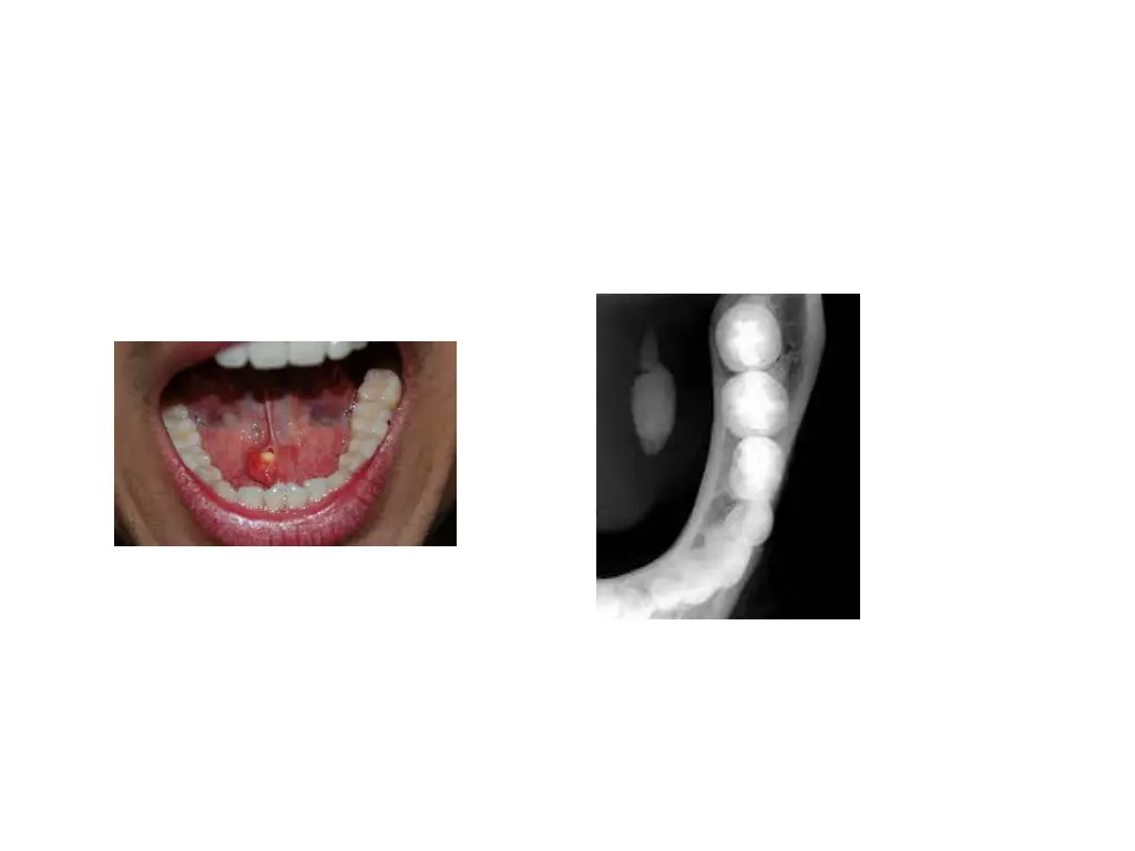 slide14