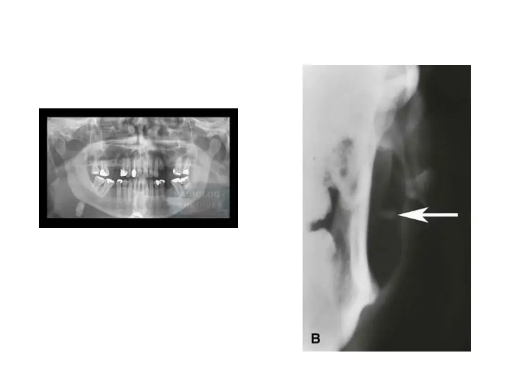slide16