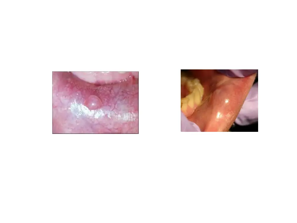 slide22