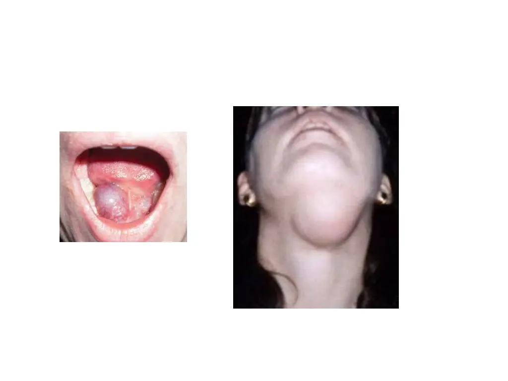 slide26