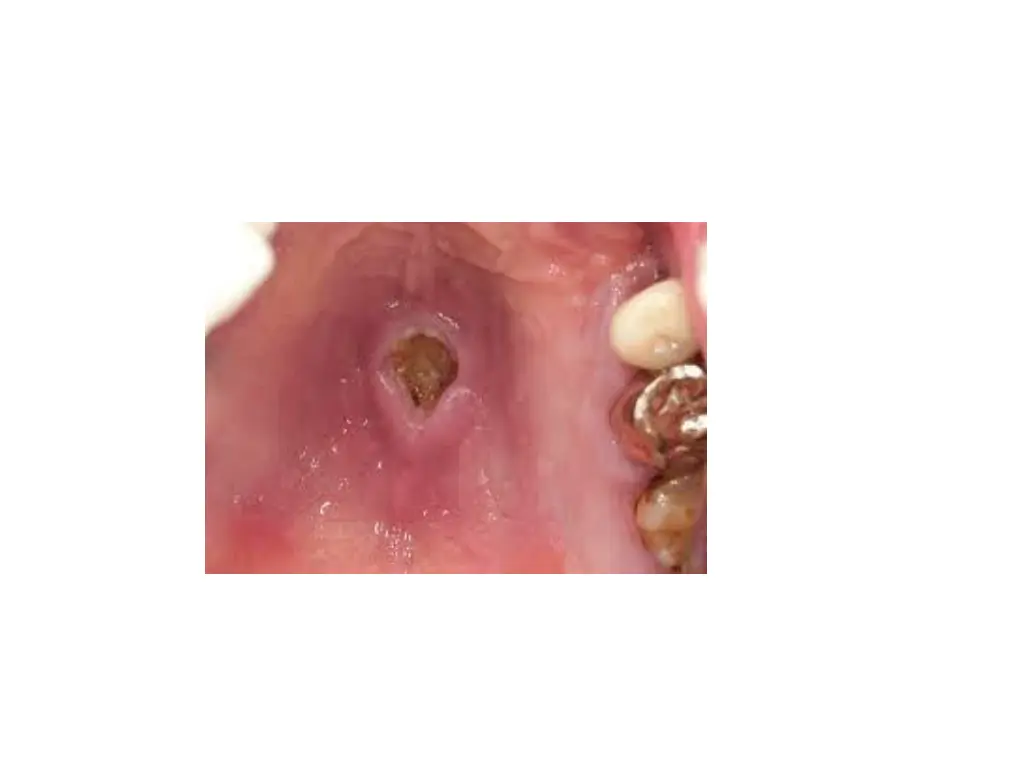 slide30