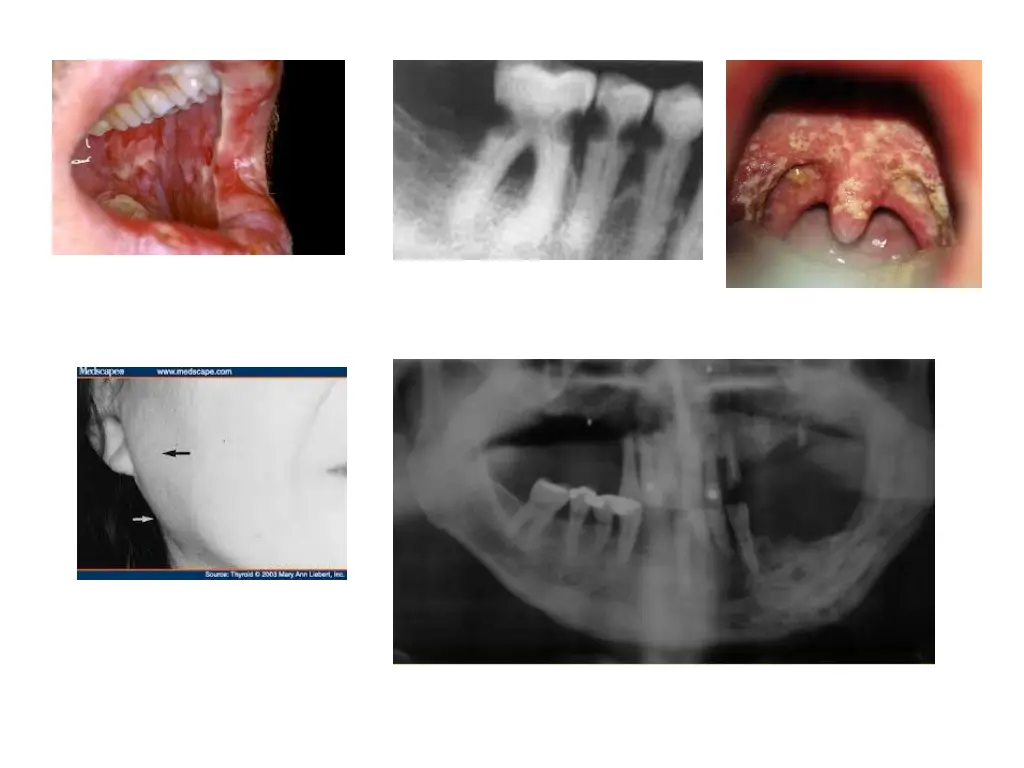 slide35