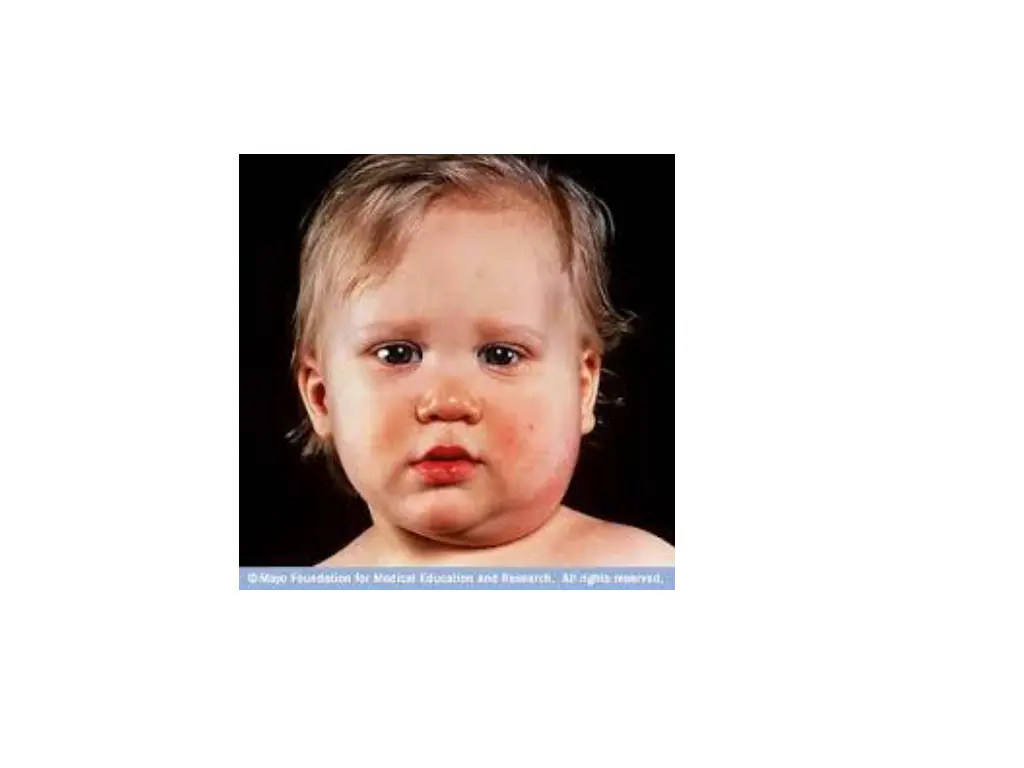 slide44
