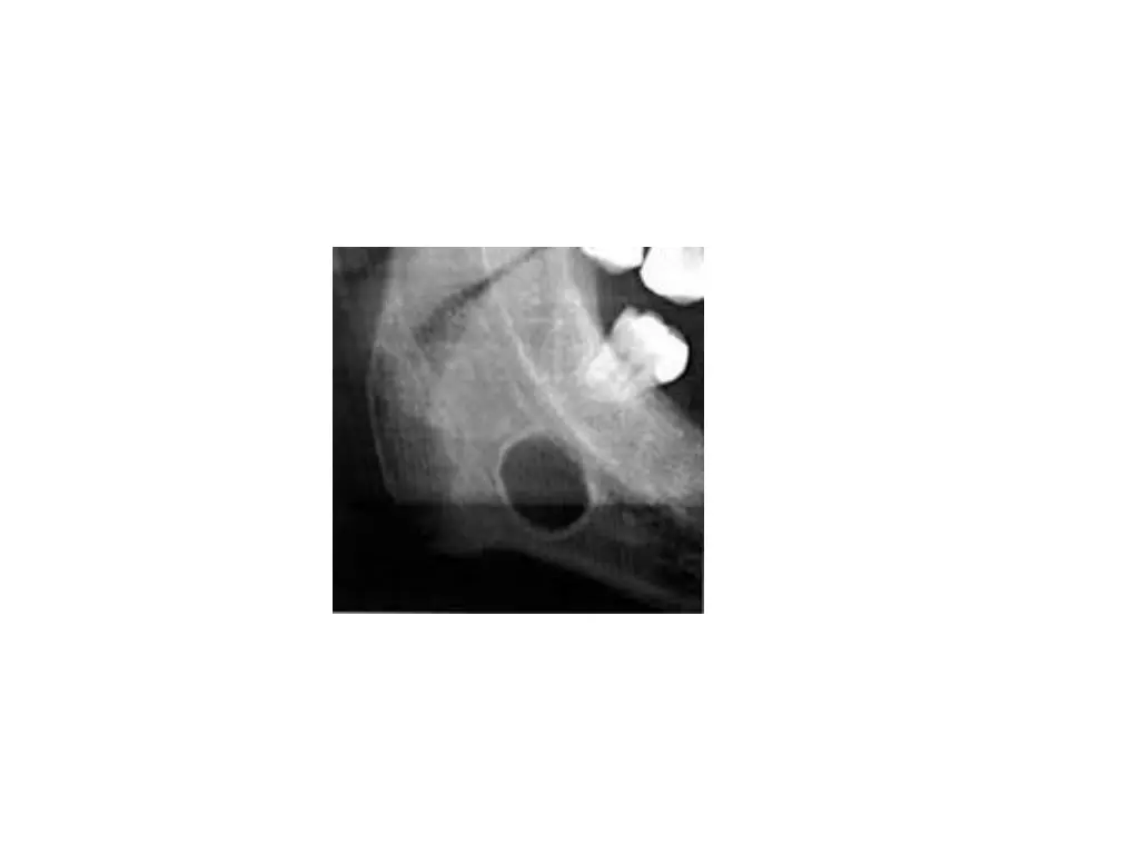slide5