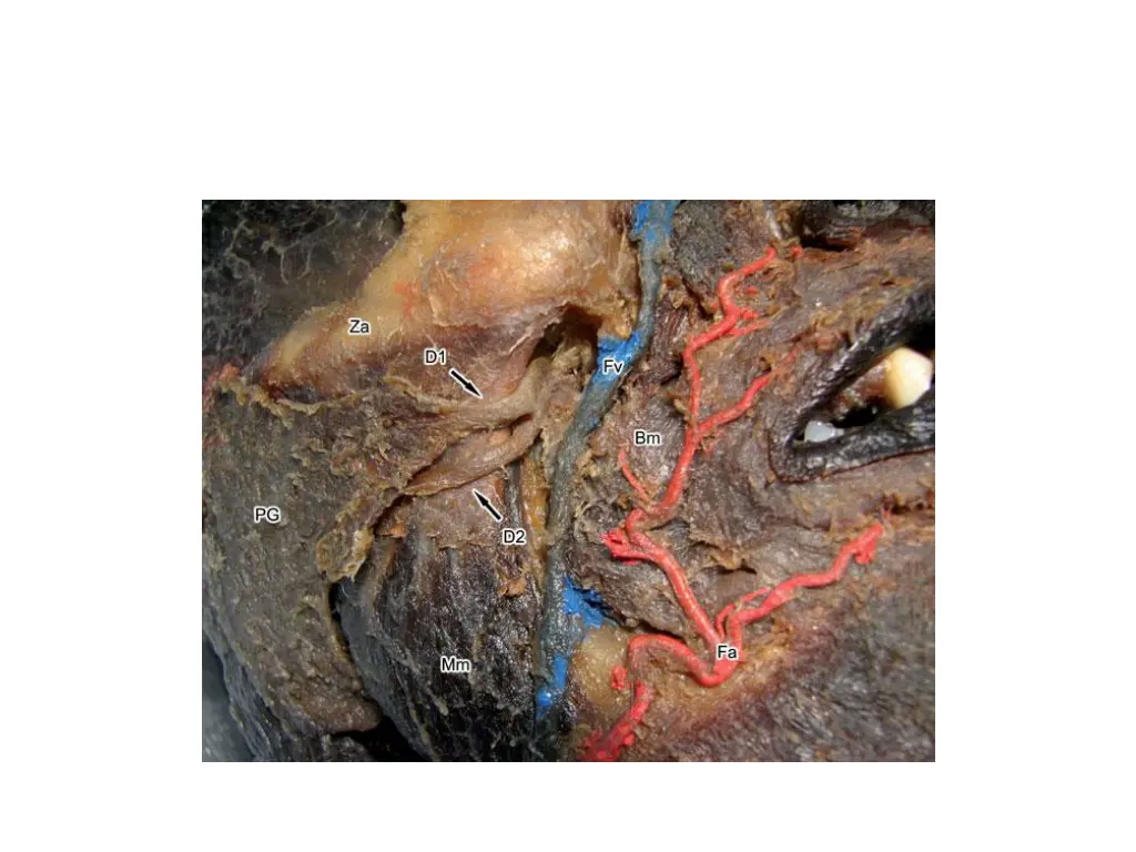 slide7