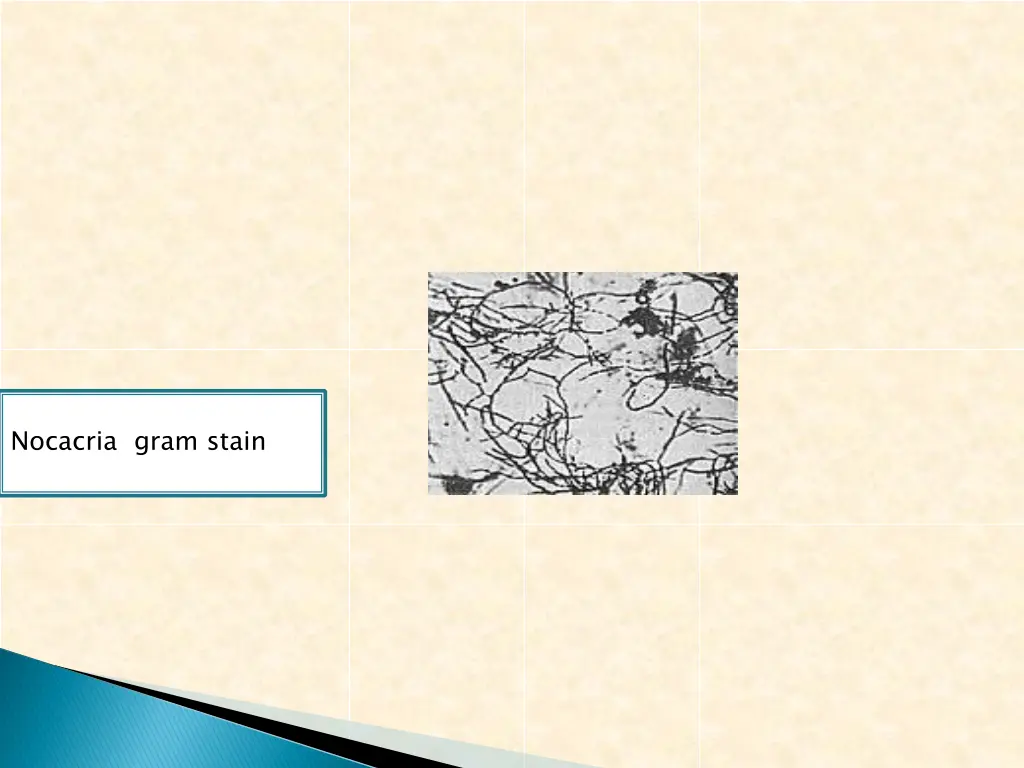 nocacria gram stain