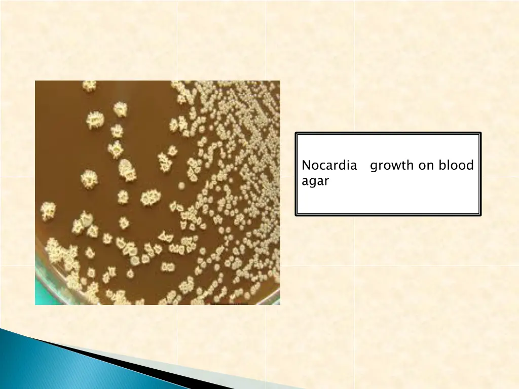 nocardia agar
