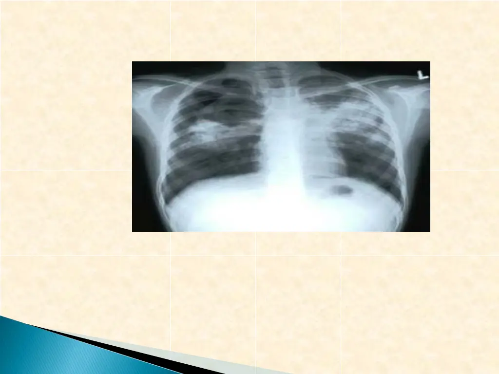 slide12