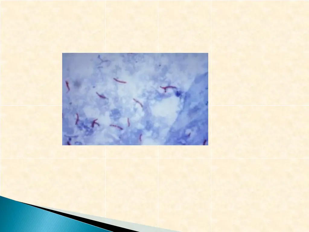 slide18