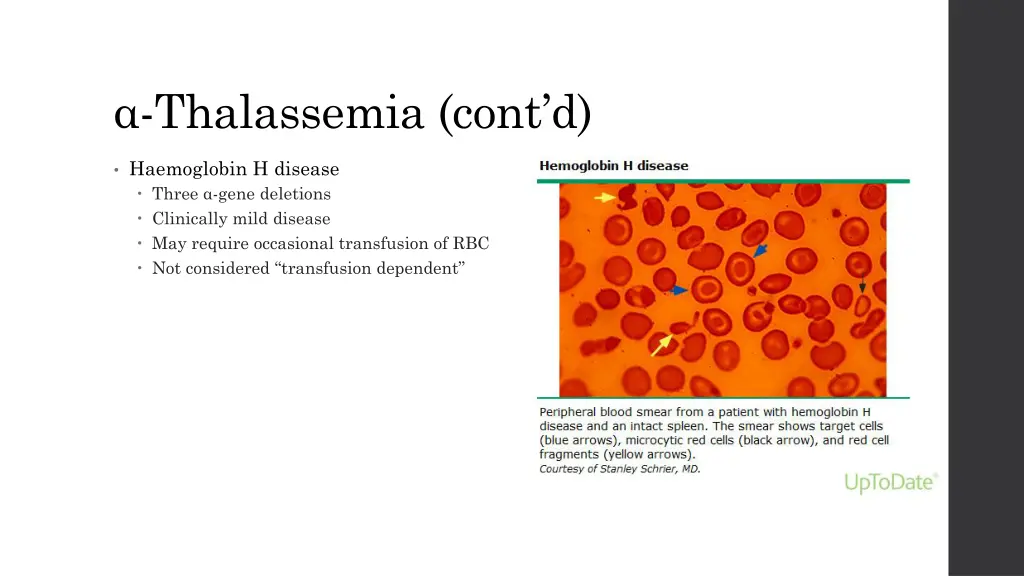 thalassemia cont d