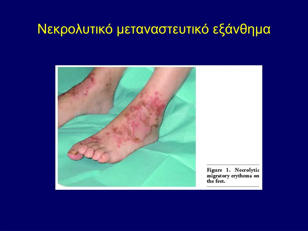slide31