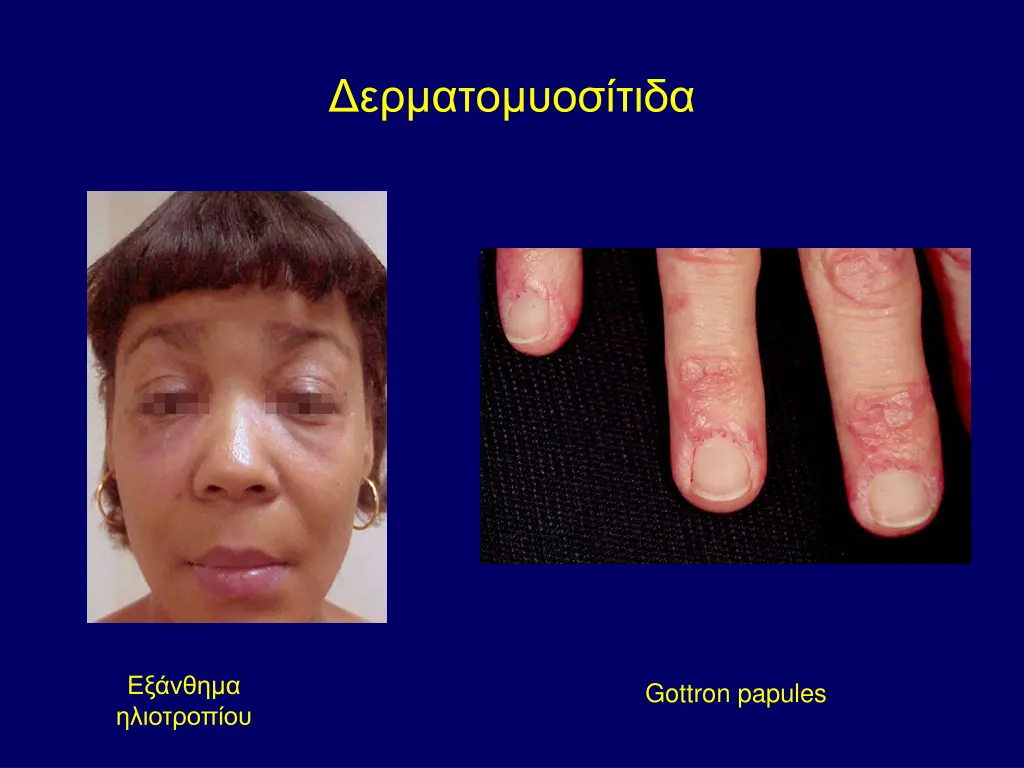 slide33