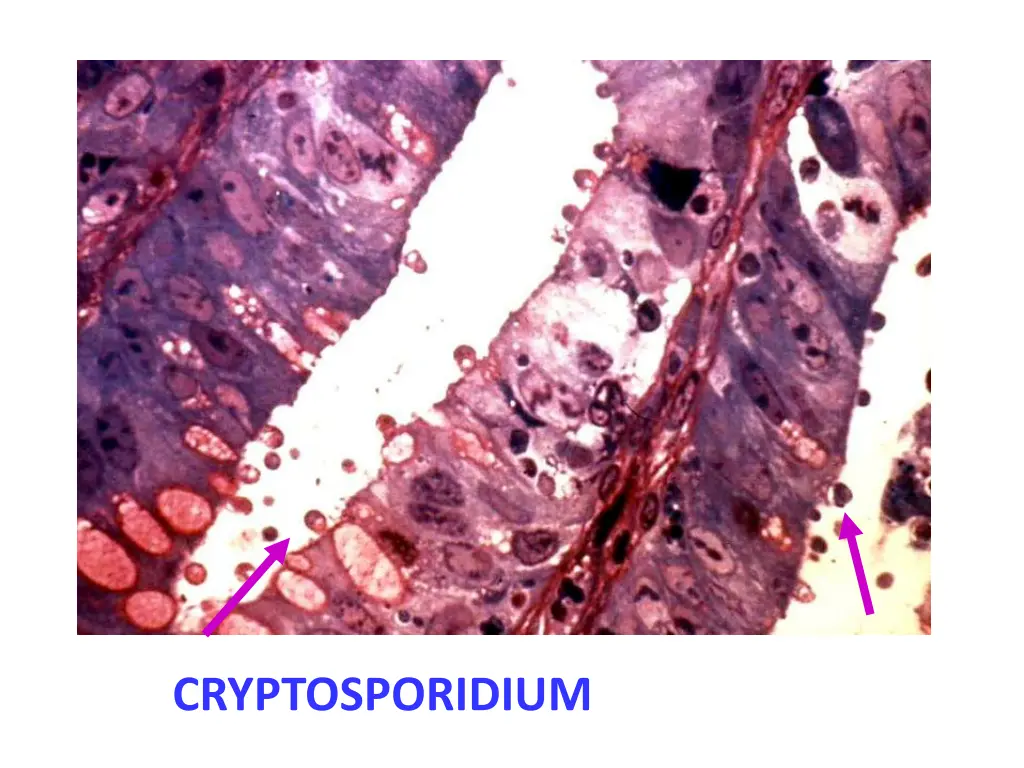 cryptosporidium