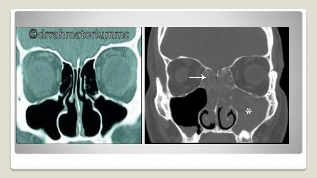 slide7