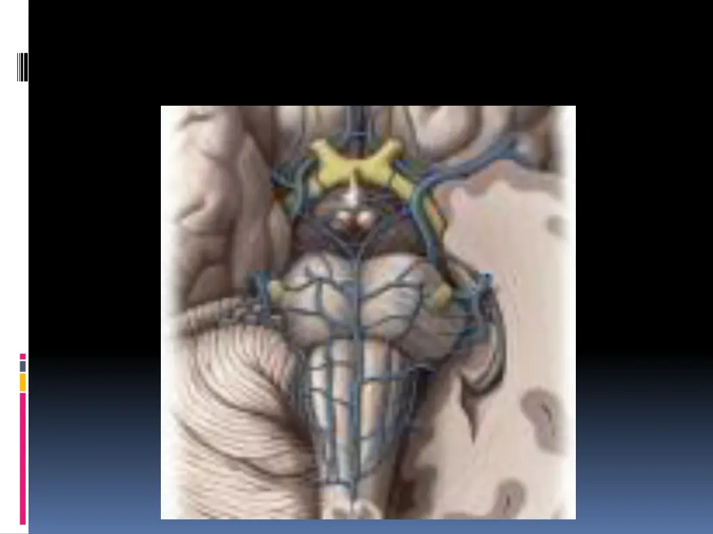 slide29