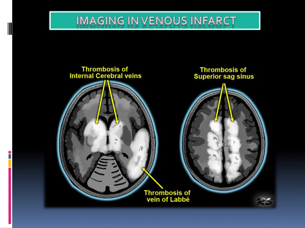 slide39
