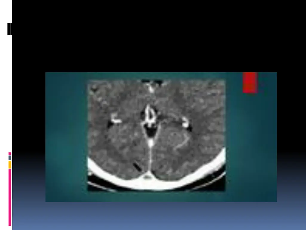 slide43