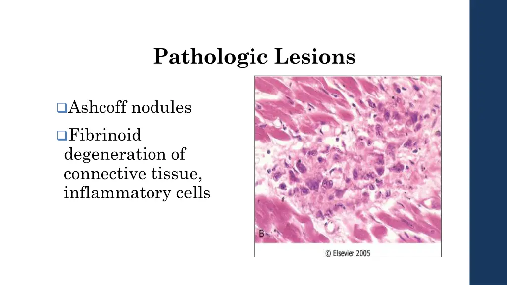 pathologic lesions