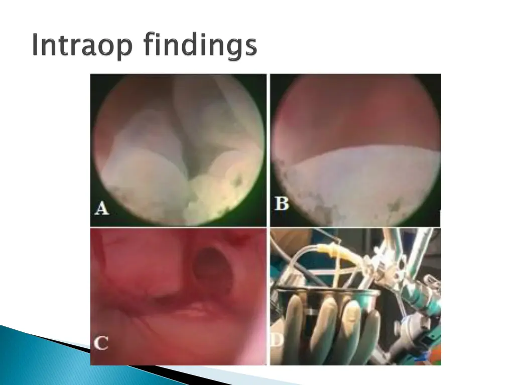 slide7