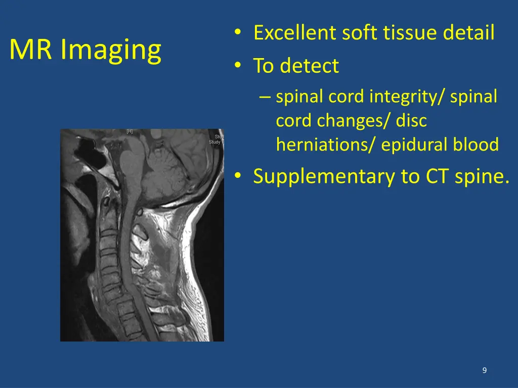 excellent soft tissue detail to detect spinal