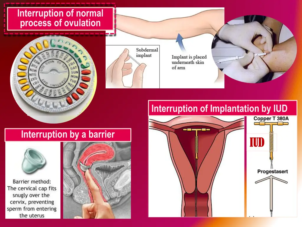 interruption of normal process of ovulation