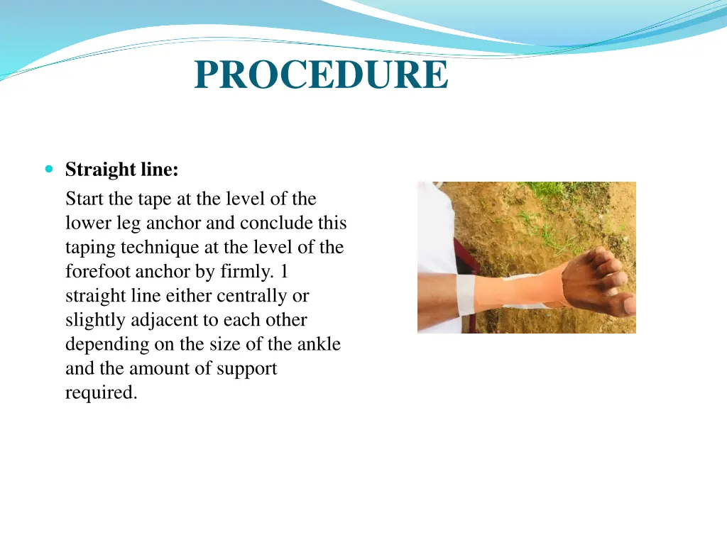 procedure 2